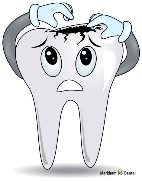 Зубик с кариесом для показа детям