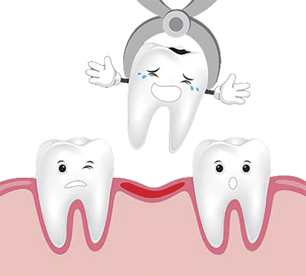 Макет зубов кариес