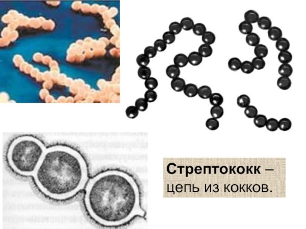 Стрептококки цепочка из кокков