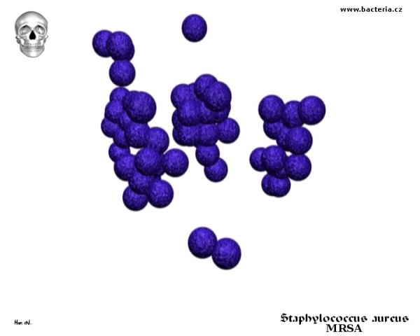 Микрококки диплококки стрептококки стрептококки стафилококки