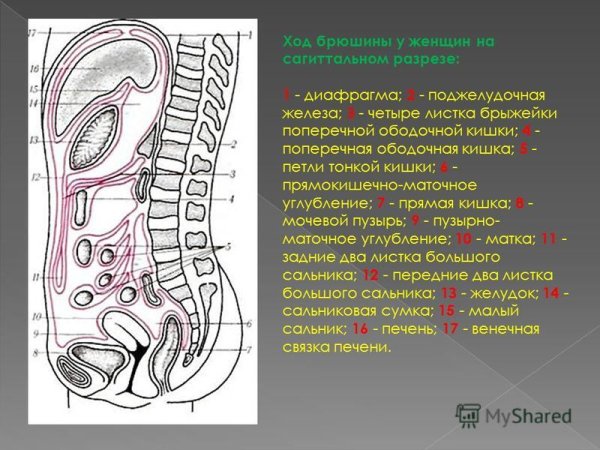 Ход брюшины на сагиттальном разрезе живота