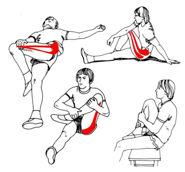 Синдром грушевидной мышцы растяжка