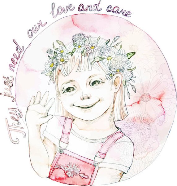 Рисунок Дауна