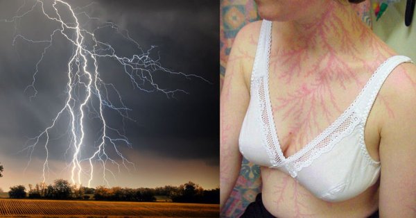 Аппарат Лихтенберга