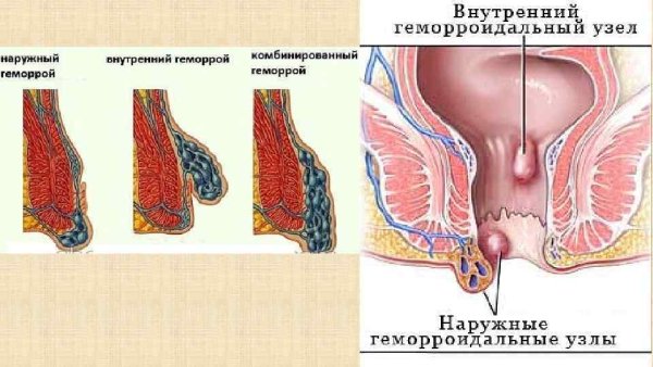 Наружный сфинктер заднего прохода анатомия