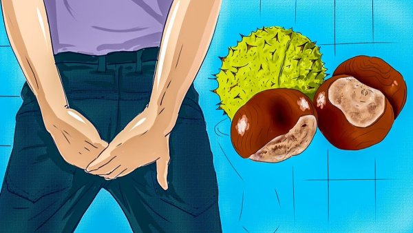 Гемморойпри беременности