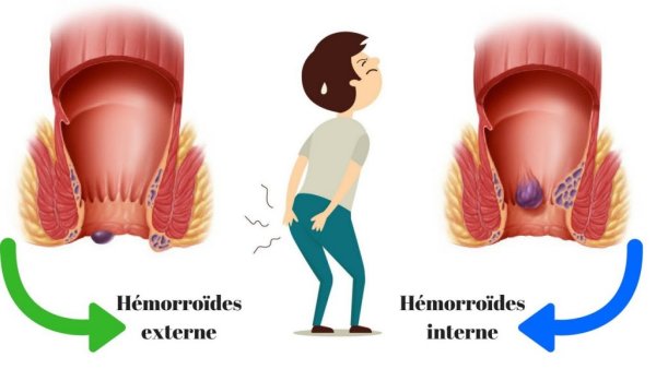 Внешний сфинктер заднего прохода