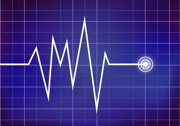 График сердцебиения