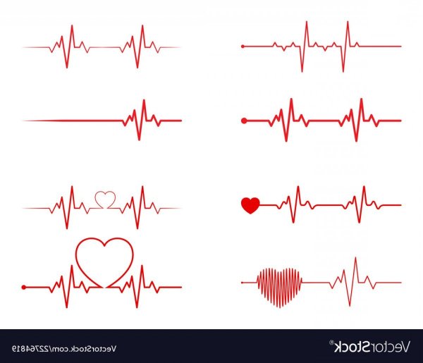 Ритмы сердца на ЭКГ