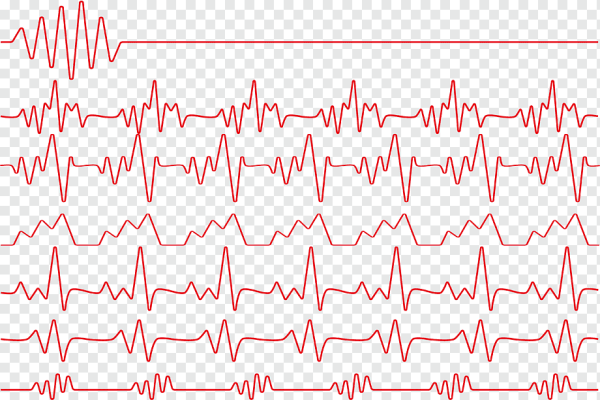 График сердцебиения
