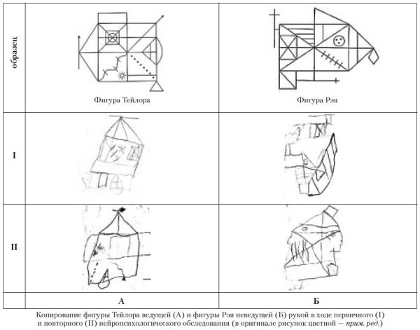 Фигуры Тейлора и Рея Остеррица