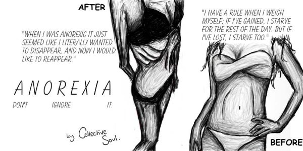 РПП рисунки