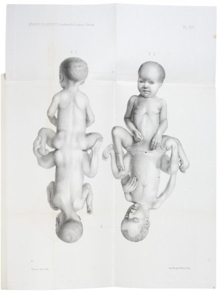 Сиамские Близнецы арт