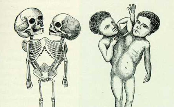 Референсы сиамские Близнецы