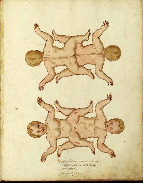 Близняшки Фрэн БОУ