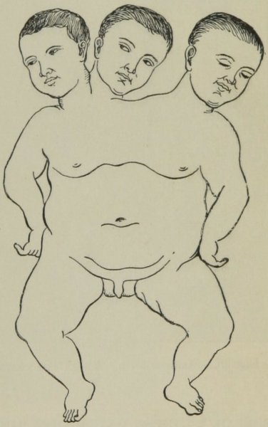 Сиамские Близнецы позы