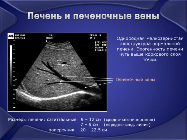 Топографическая анатомия печеночных вен