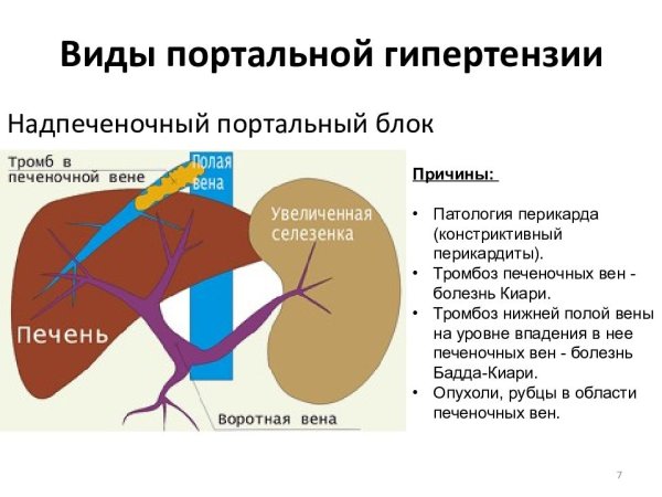 Система циркуляции крови в печени