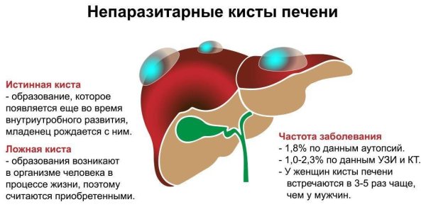 Строениедольуи печени