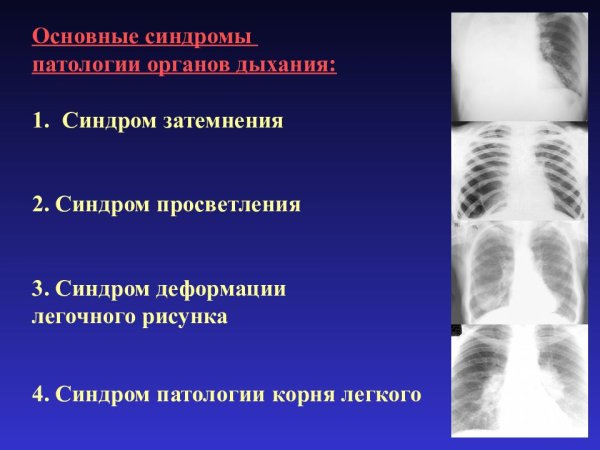 Патология органов дыхания