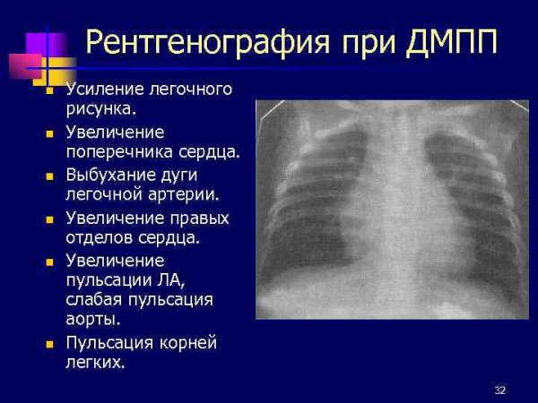 Структурность корня легкого