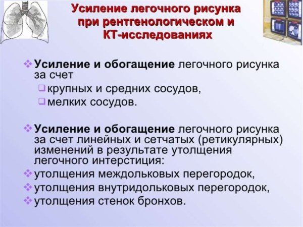 Обеднение легочного рисунка