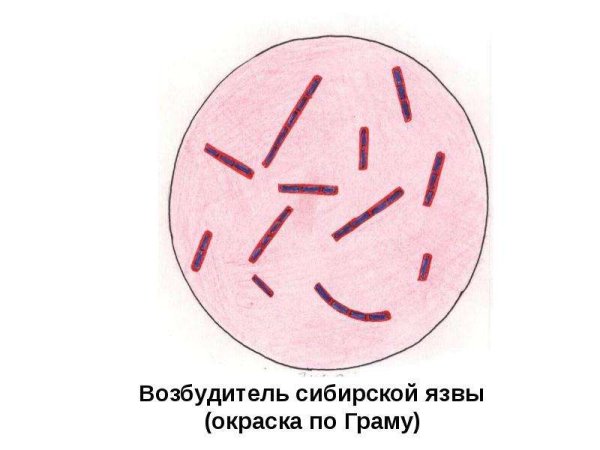 Сибирская язва микробиология