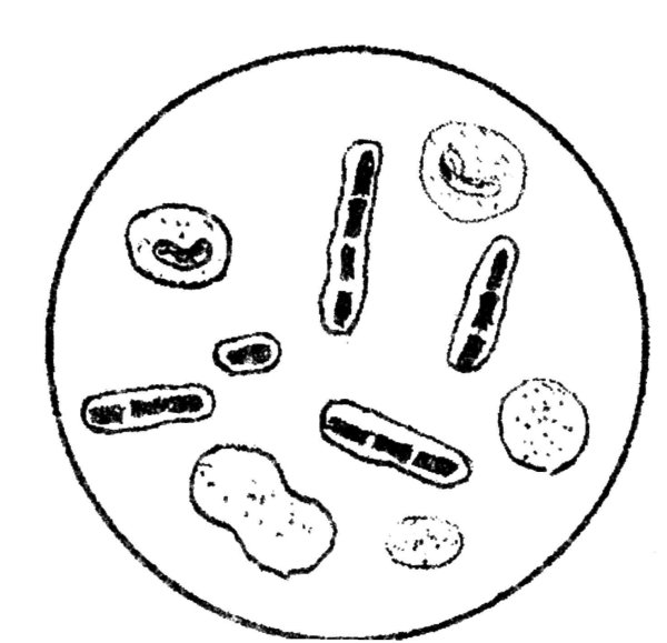 Бациллы сибирской язвы микробиология