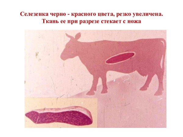 Септическая форма сибирской язвы