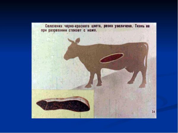 Сибирская язва кожная форма у человека