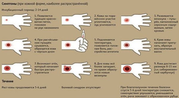 Стадии развития кожной формы сибирской язвы