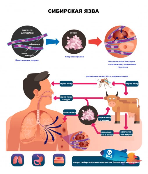 Сибирская язва возбудитель пути заражения