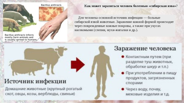 Сибирская язва возбудитель болезни способ заражения