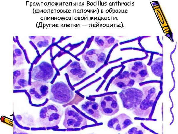 Возбудитель - Bacillus anthracis