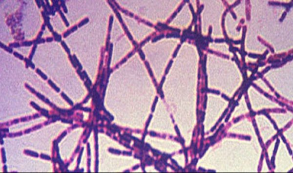 Эндоспора сибирской язвы