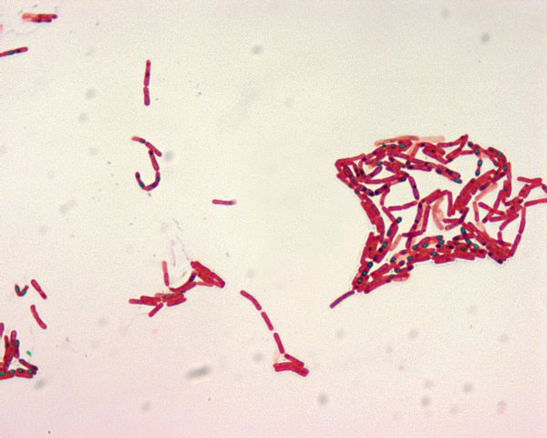 Bacillus anthracis окраска по Ожешко