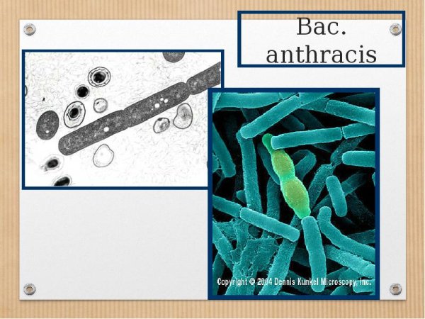 Сибирская язва животных презентация