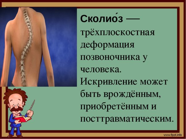 С-образный сколиоз