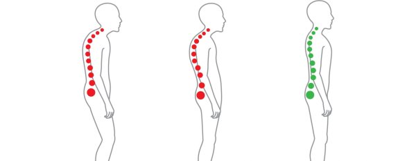 Осанка и искривление позвоночника