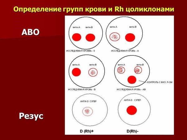 Группа крови и резус фактор Цоликлоны