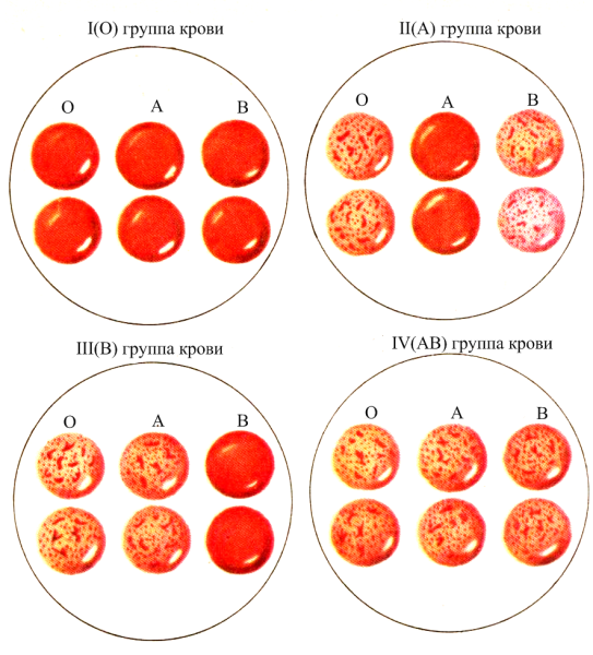 Как определить группу крови 1 положительная