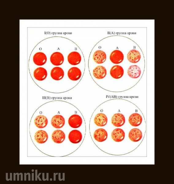 Расшифровка группы крови и резус-фактор
