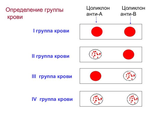Как определяется группа крови