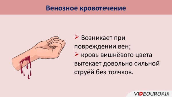 При венозном кровотечении кровь вытекает