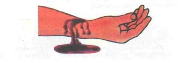 Наружное кровотечение