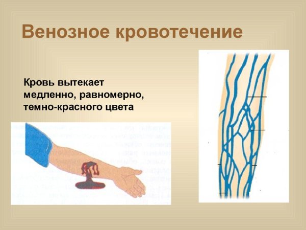 При венозном кровотечении кровь вытекает