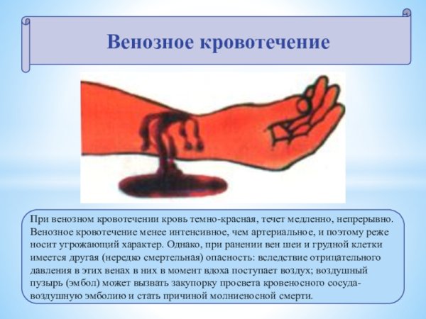 При венозном кровотечении