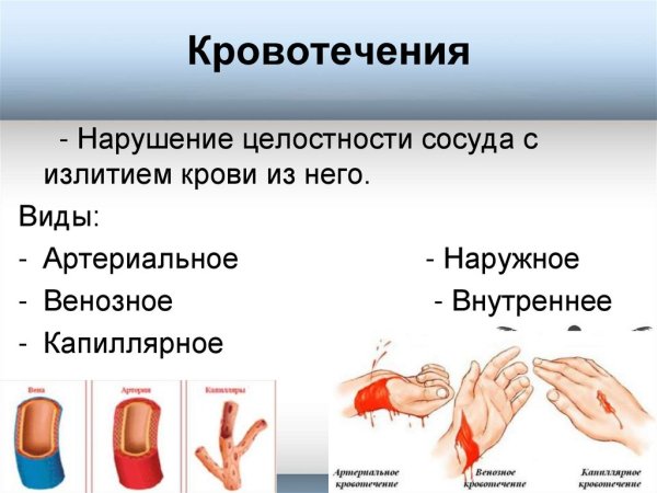 Артериальное венозное и капиллярное кровотечение