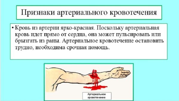 Симптомы внешнего артериального кровотечения