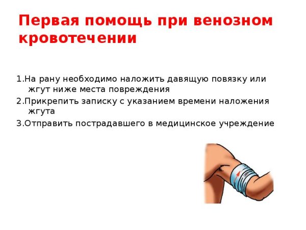 ПМП при венозном кровотечении
